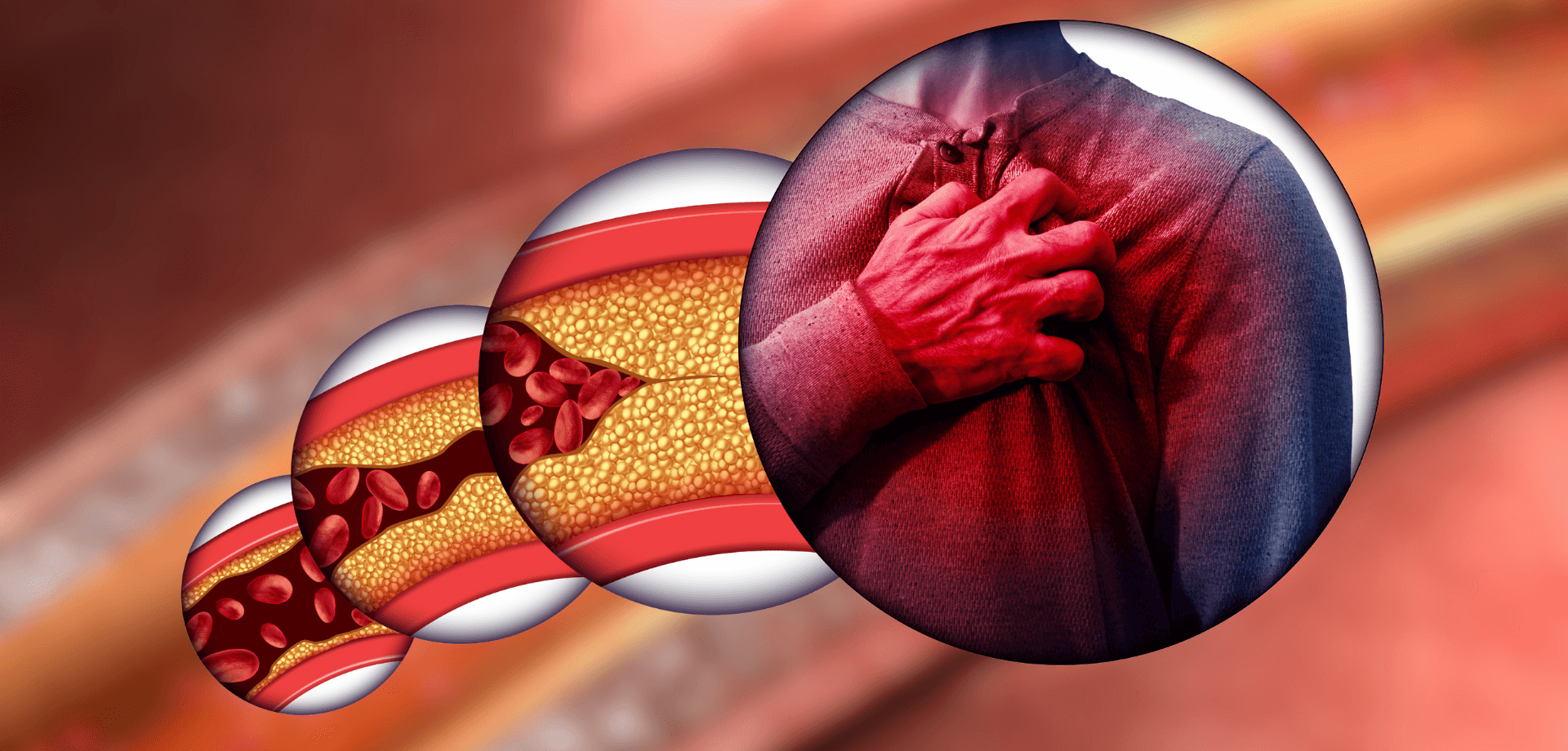 Recognizing the Early Signs of Heart Attacks and Coronary Disease